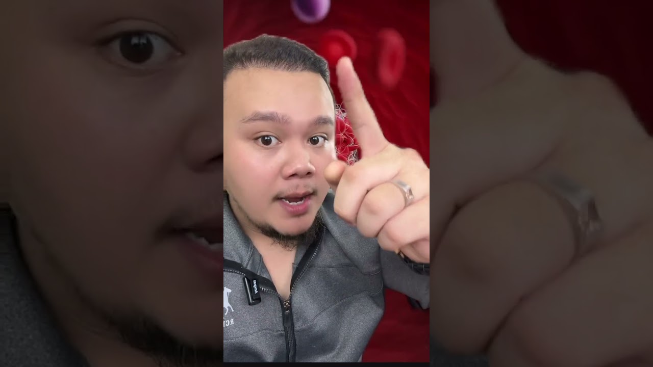 UMUR BARU 17 TAHUN, MACAM MANA BOLEH KENA STROKE BERDARAH ( HEMORRHAGIC STROKE )