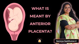 What is meant by Anterior placenta ? | What is an Anterior Placenta?