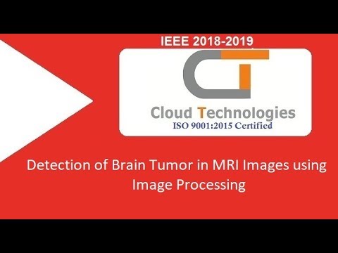 Detection of Brain Tumor in MRI Images using Image Processing | ML  Projects Hyderabad