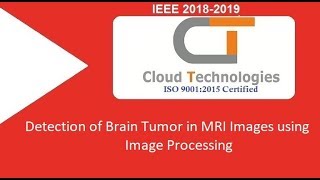 Detection of Brain Tumor in MRI Images using Image Processing | ML  Projects Hyderabad
