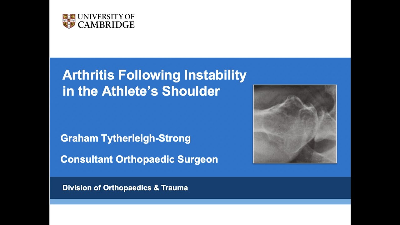Shoulder Arthritis Following Instability in the Athlete YouTube