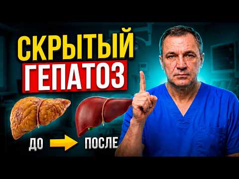 Жировая болезнь печени: как очистить печень от жира без таблеток?