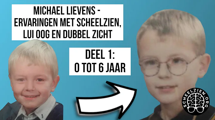 Michael Lievens - Ervaring met scheelzien, lui oog...