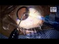 Live Surgical Demonstration: ICL Toric Implantation by Dr. Gaurav Luthra