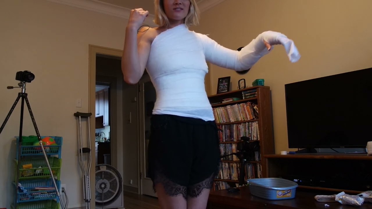 Наложение гипса на верхнюю часть тела Эмили завершено!