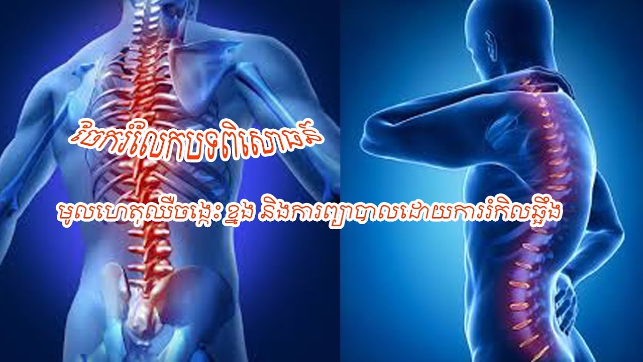 ការព្យាបាលពិសេស សម្រាប់អ្នកឧស្សាហ៍ឈឺខ្នង ចង្កេះរ៉ាំរ៉ៃ...