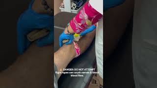 Knee Pain Relief #painrelief #acupressure #massage #trending #kneepain #trendingshorts #therapy