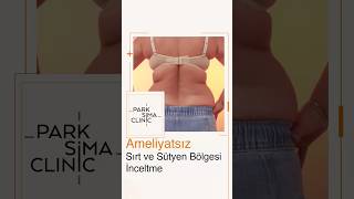 Ameliyatsız Sırt ve Sütyen Bölgesi İnceltme