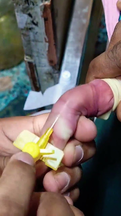 how to insert a cannula for child || 3 days child #neet2023 #neetexam #shorts #viral #viralshorts