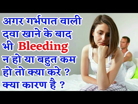 वीडियो: क्या मुझे डैश इंस्टॉल किट की आवश्यकता है?