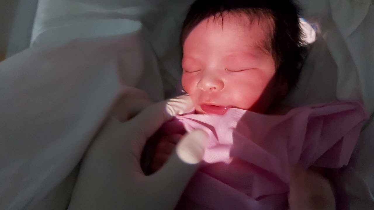 Red reflex ,neonatal examination before discharge،cataract, leukocoria