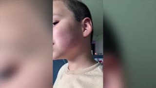 Cutler Bay mother demands answers after she says her son was slapped by his music teacher by WSVN-TV 1,022 views 6 days ago 3 minutes, 4 seconds