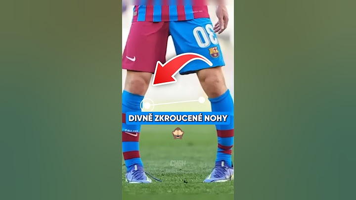 Proč mají Fotbalisti DIVNĚ ZKROUCENÉ NOHY?! 🦵😱