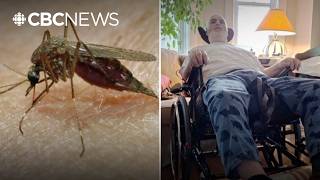 West Nile virus: How one mosquito bite nearly killed him