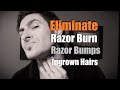 How To Eliminate Razor Burn, Bumps and Ingrown Hairs | Razor Burn Prevention