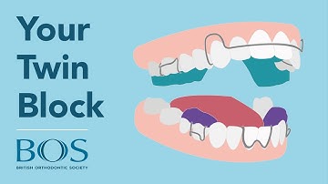 Your Twin Block: Advice | Tips | Tricks