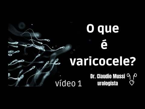 O que é varicocele?