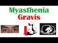 Myasthenia Gravis | Pathophysiology, Signs & Symptoms, Diagnosis, Treatment