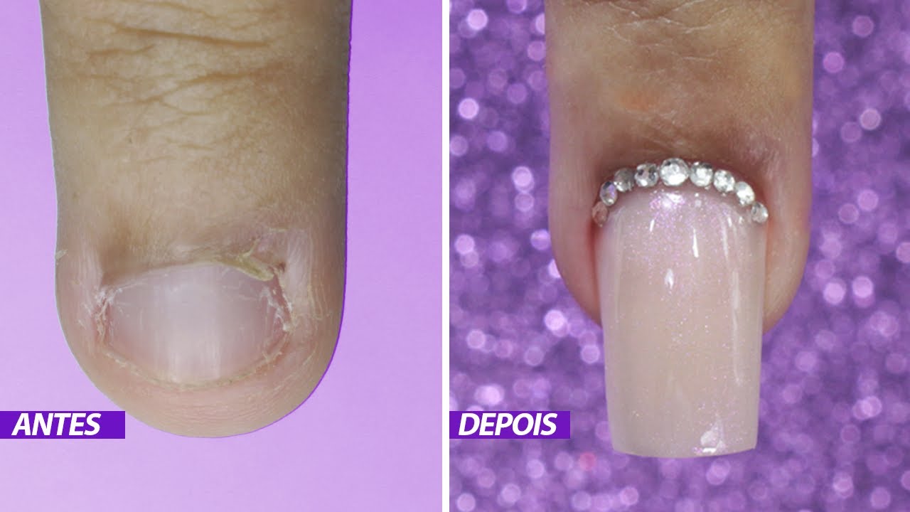 Unha Roida TRANSFORMAÇÃO NAS UNHAS DE GEL ANTES E DEPOIS - YouTube