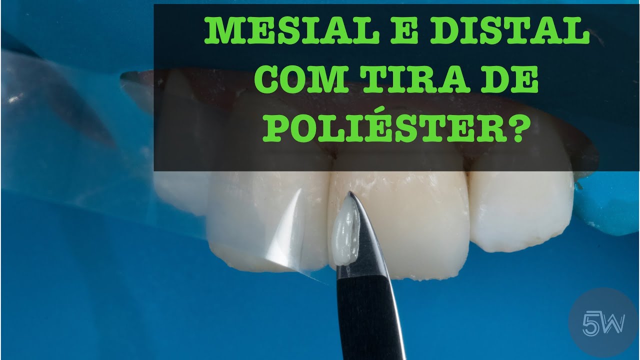 Fazendo a concha com matriz de poliéster