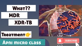 What is MDR/XDR-TB || How to treat MDR patients || Drug-resistant tuberculosis (One-page notes)