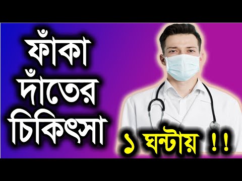 ফাঁকা দাঁতের চিকিৎসা || Faka dater Treatment || Gap Between Teeth  || Bangla.orthodontics.smile bd.