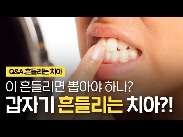 갑자기 흔들리는 치아가 걱정이에요! 빼야하나? 치주인대 치료방법 ⏰1분 치아상식