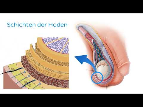 Knubbel am Hoden - Ist das Hodenkrebs? | Urologie am Ring