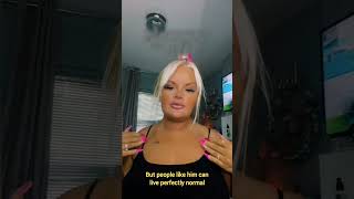 Rare Shoulder Disease shorts