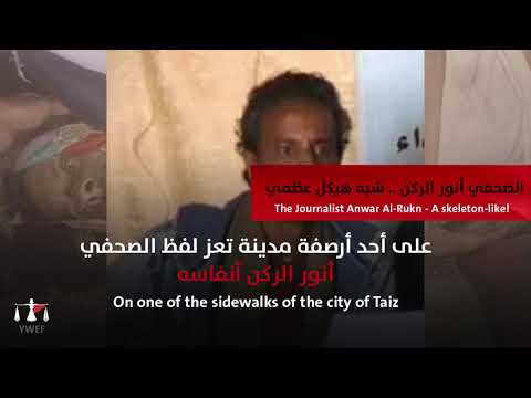 أنور الركن... شبه هيكل عظمي #١٠٠_حكاية_انسانية_من_اليمن #100_humanity_tale_from_yemen