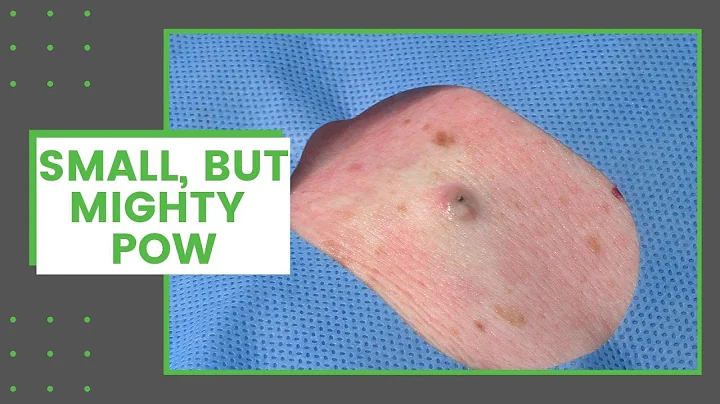 Small, But Mighty POW | Dr. Derm