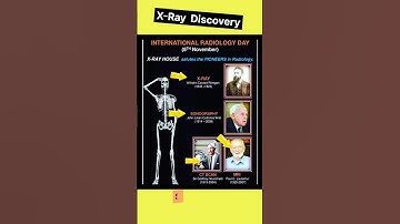 Father of X-Rays , Sonography , CT Scan & MRI #shorts #xray #radiology
