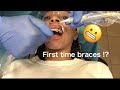 Getting Braces Vlog