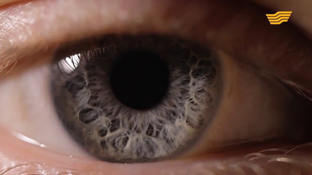 Опасность глаукомы глаукома: причины и проявления
