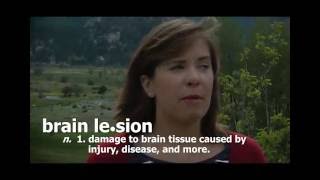 Brain Awareness Video Contest: Three Lesions, Three Lives