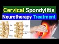 Cervical spondylitis neurotherapy treatmentneck pain  cervical pain treatmentcervical spondylosis