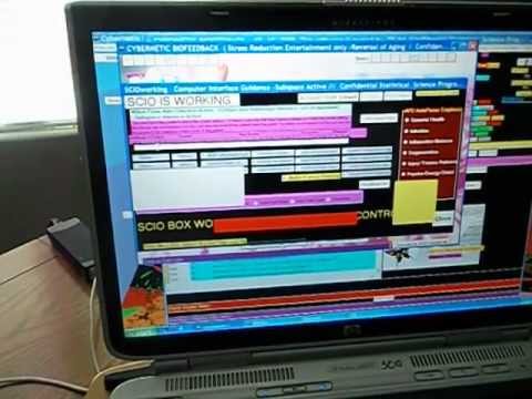 prueba qxci para diabetes