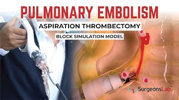 Pulmonary Embolism Thrombectomy Model – Realistic Hands-On Training in Action