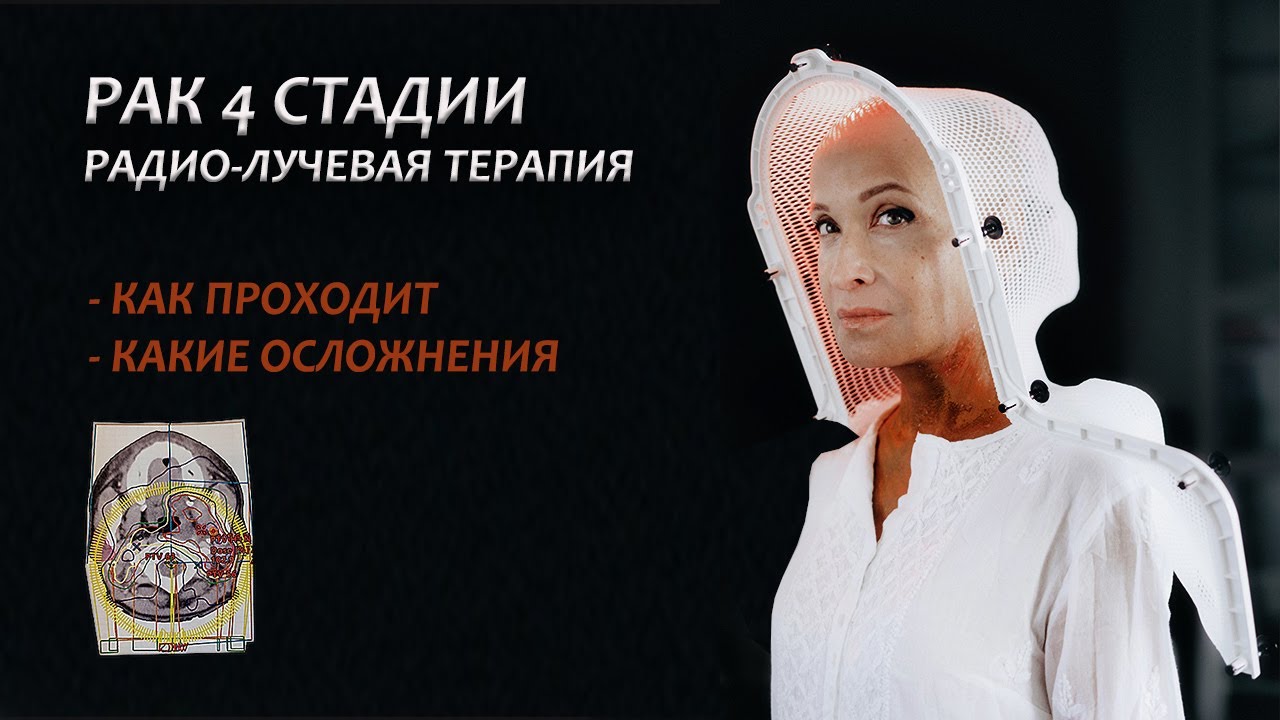Рак 4 стадии. Моя история онкологии. Про радио-лучевую терапию. Серия 14