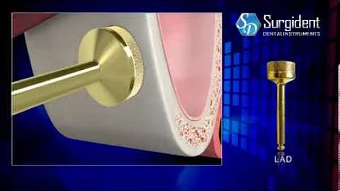 TOLA Sinus Lift Lateral Approach Kit