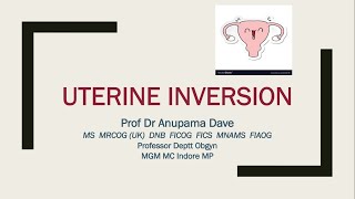 Uterine Inversion #LecturesinObstetricsandGynaecologyProfDrAnupamaDave