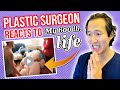 Doctor Reacts to MY 600 LB LIFE! Massive lymphedema - Dr. Anthony Youn