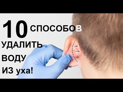 Видео: Как слить жидкость из уха (с иллюстрациями)