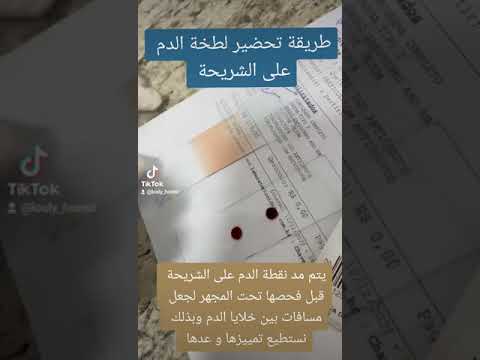 طريقة مد نقطة الدم على الشريحة لفحص خلايا الدم تحت المجهر