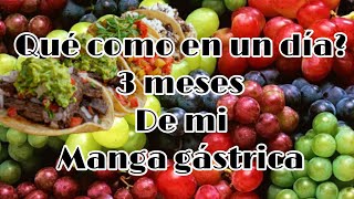 Esto Como A Los 3 Meses De Mi Cirugía Manga Gástrica