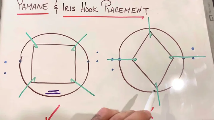 Diamond vs Square Iris Hook Placement for the Yamane Technique - Dr Rami Shasha MD
