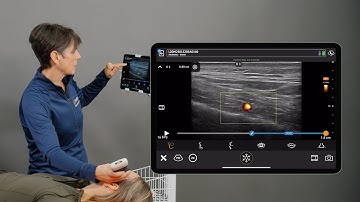 Performing Distance Measurements