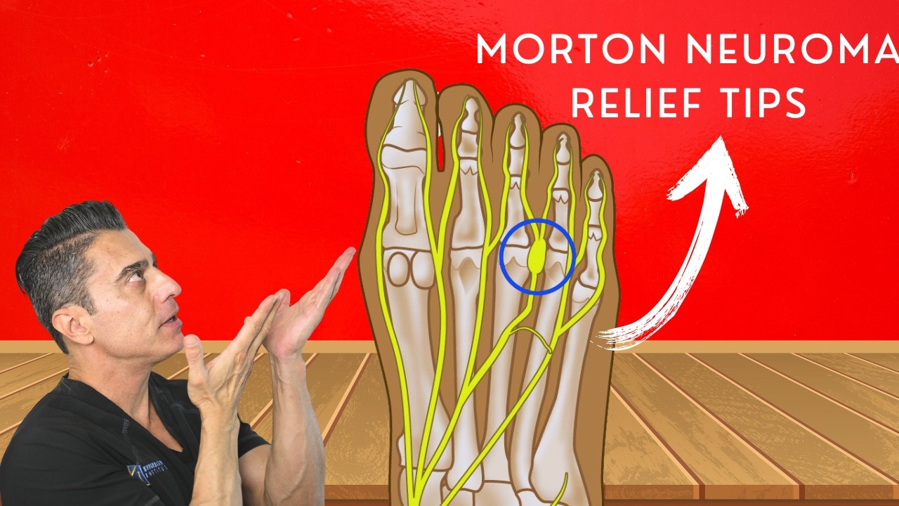 Relieve Morton’s Neuroma Pain: Best Tips and Tricks