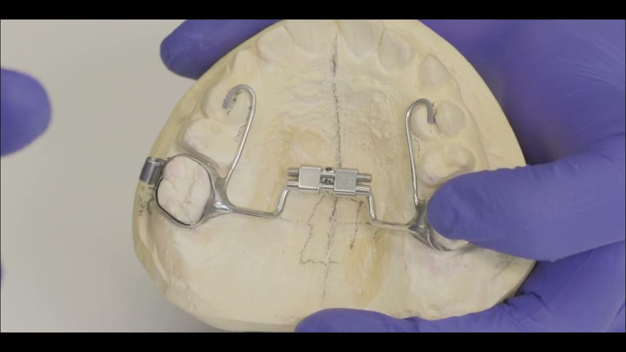 How To Turn Your Expander YouTube