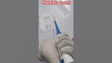 Platelets Count || Manual method || Neubauer chamber #Platelets#PlateletCount#HealthAwareness#tips